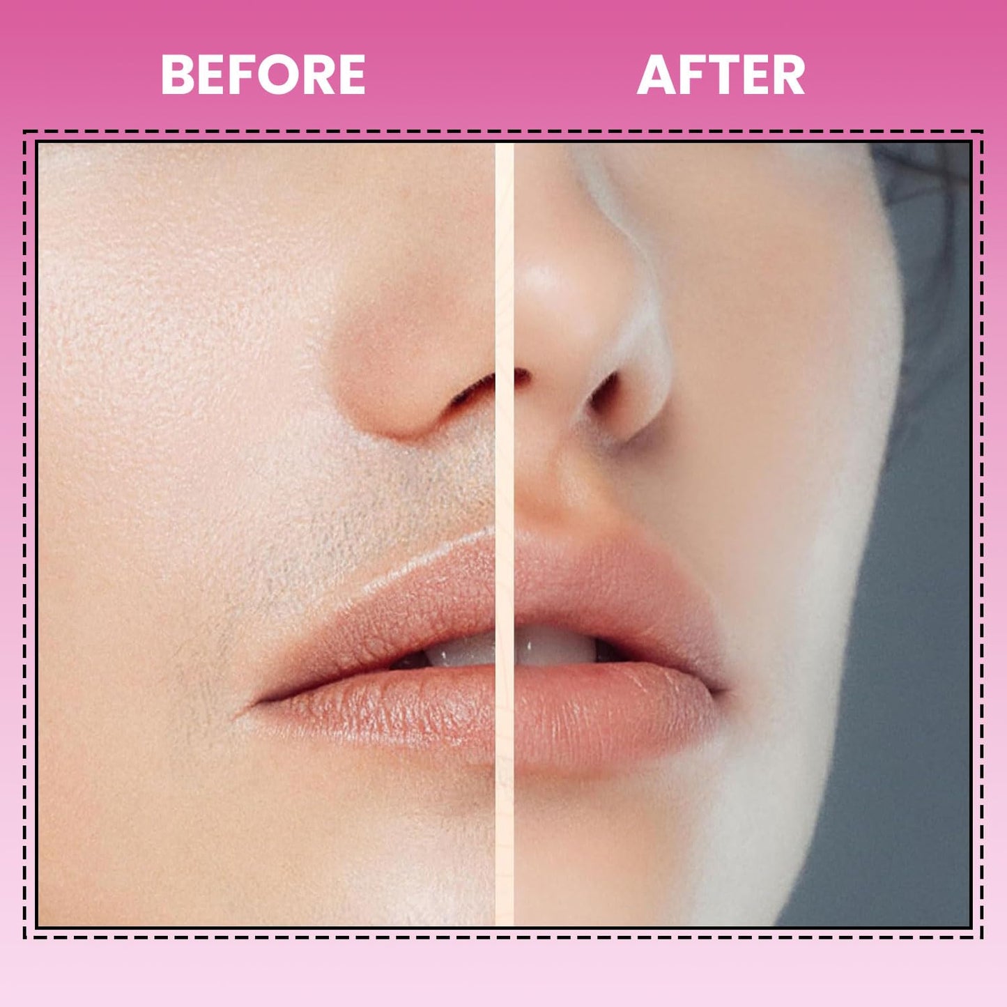 Infinity Choices Facial Hair Remover for Women – Electric Face Razor with Light, Hair Removal for Upper Lip, Chin & Cheeks