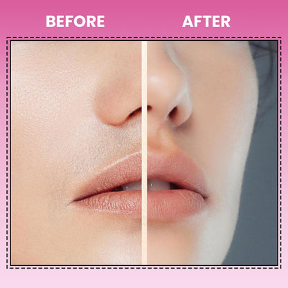 Infinity Choices Facial Hair Remover for Women – Electric Face Razor with Light, Hair Removal for Upper Lip, Chin & Cheeks