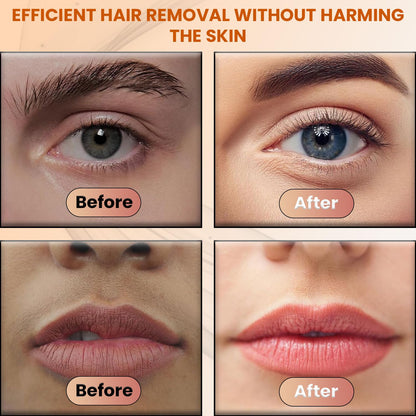 Infinity Choices Facial Hair Remover for Women – Electric Face Razor with Light, Hair Removal for Upper Lip, Chin & Cheeks