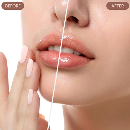 Infinity Choices Facial Hair Remover for Women – Electric Face Razor with Light, Hair Removal for Upper Lip, Chin & Cheeks