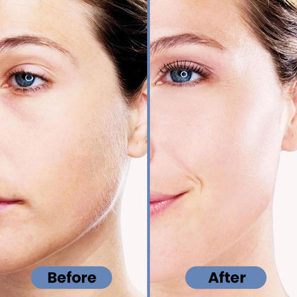 Infinity Choices Facial Hair Remover for Women – Electric Face Razor with Light, Hair Removal for Upper Lip, Chin & Cheeks