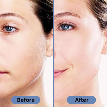 Infinity Choices Facial Hair Remover for Women – Electric Face Razor with Light, Hair Removal for Upper Lip, Chin & Cheeks