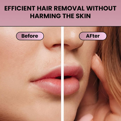Infinity Choices Facial Hair Remover for Women – Electric Face Razor with Light, Hair Removal for Upper Lip, Chin & Cheeks